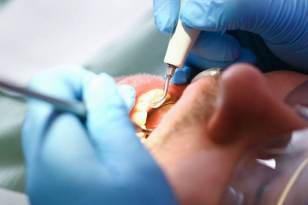 Best Mobile Emergency Dentist in Surf City, NC